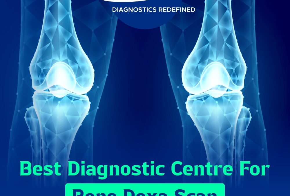 Best Diagnostic Centre for Bone DEXA Scan in Delhi – Orbit Imaging & Pathlab